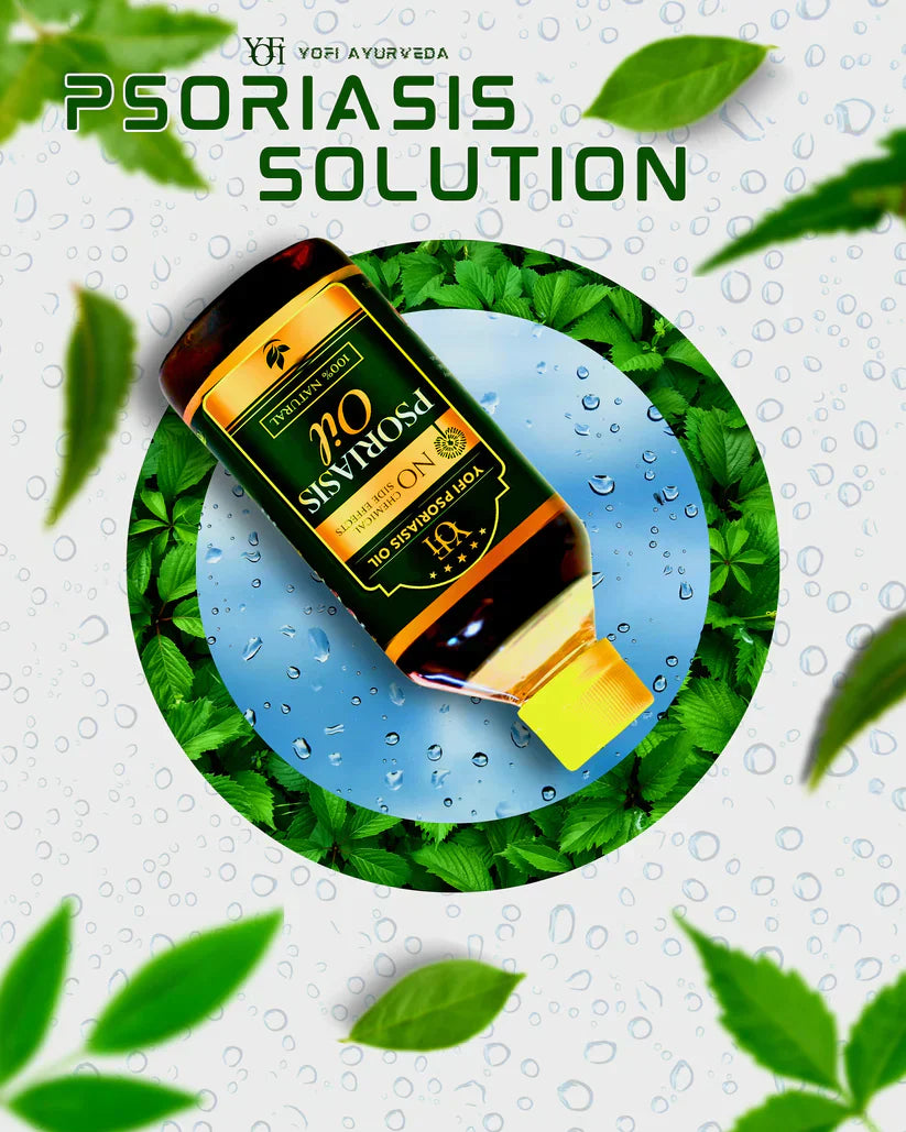 Vida Herbals Psoriasis Oil-Advanced Psoriasis Clearing Oil
