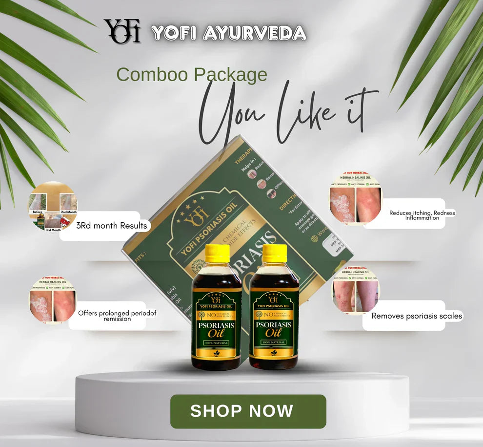 Vida Herbals Psoriasis Oil-Advanced Psoriasis Clearing Oil